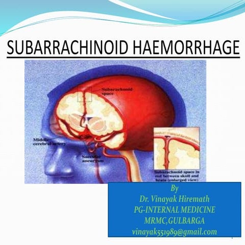 Subarachnoid hemorrhage
