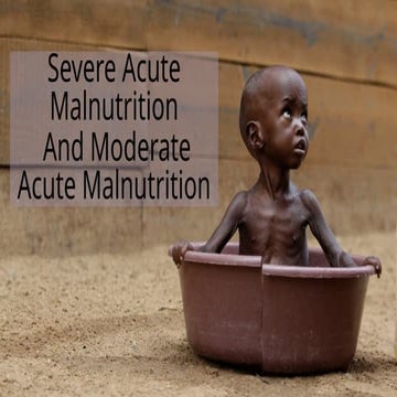 malnutrition (MAM and SAM ) in pediatrics.pptx