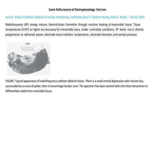 Atrial tachycardia_lecture | PDF