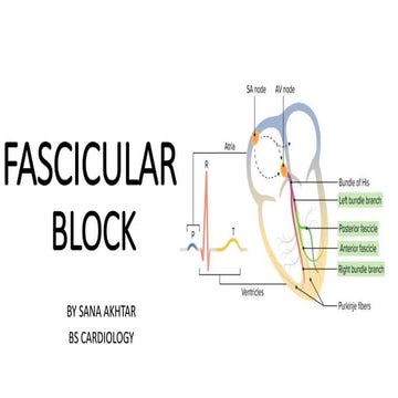 Fascicular block ECG Student explanation presentation topic(1).pdf