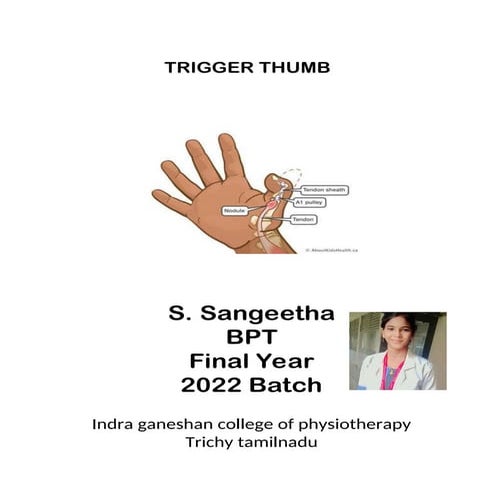 TRIGGER THUMB_By S.Sangeetha Final year 2022 batch