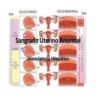 Sangrado uterino abnormal 