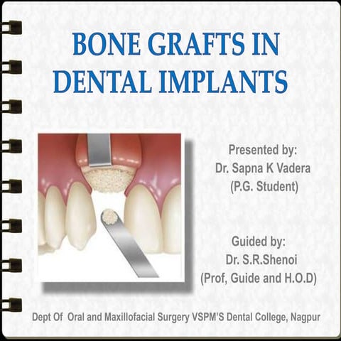 Bone grafts