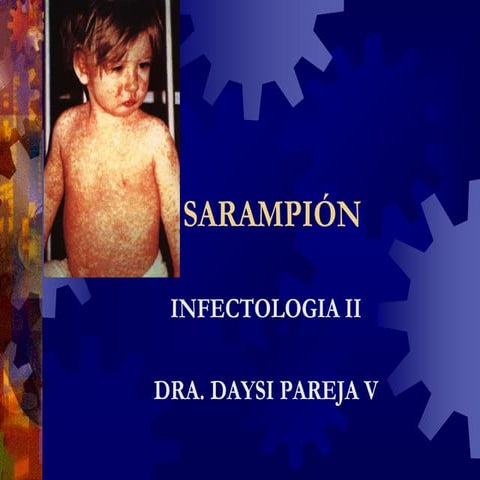 INFECTOLOGIA II - SARAMPION
