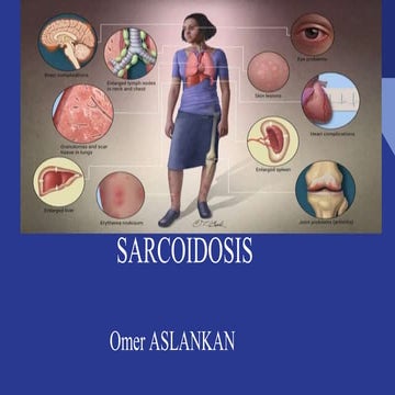 Sarcoidosis Respiratory Disease Slide Note | PPTX