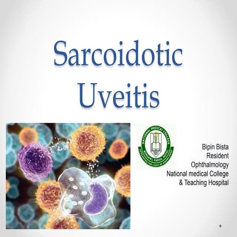 Sarcoidotic uveitis