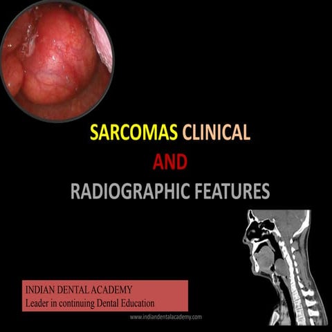 Sarcomas clinical and radiographic features /prosthodontic courses