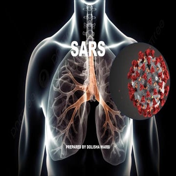 SARS (SEVERE ACUTE RESPIRATORY SYNDROME).pdf