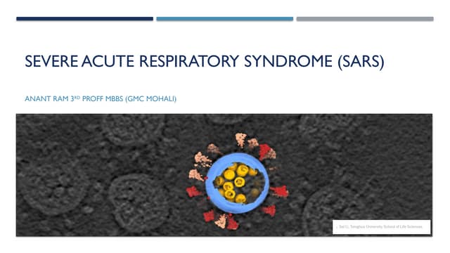 Severe Acute Respiratory Syndrome (SARS) | PPTX