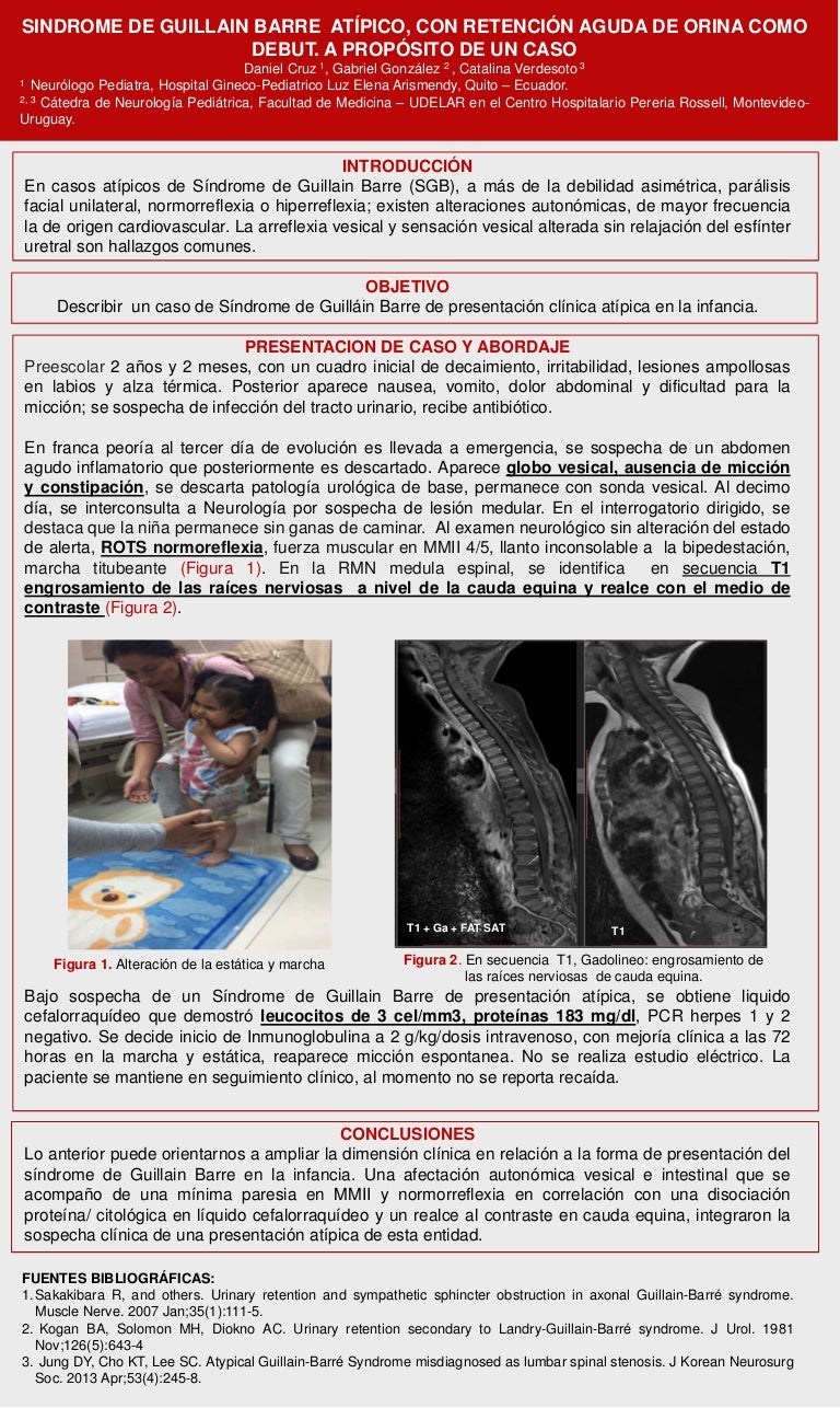 dolor de uretritis al orinar náuseas sin