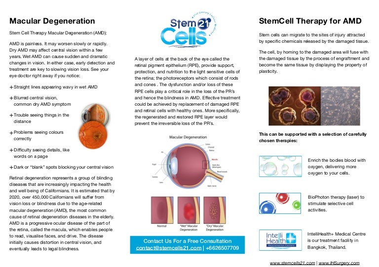 Macular Degeneration Stem Cell Therapy