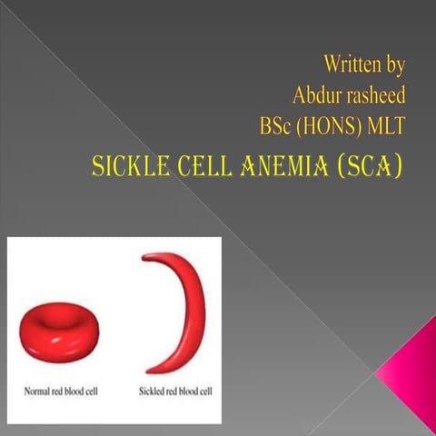Sickle Cell Anemia