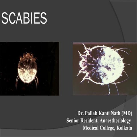 Scabies