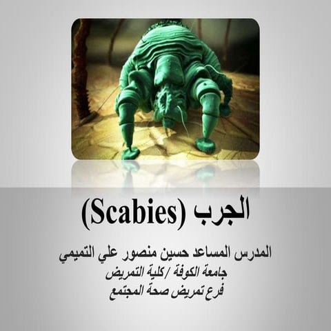 Scabies الجرب