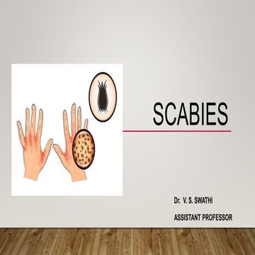 Scabies