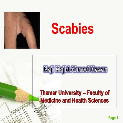 Scabies