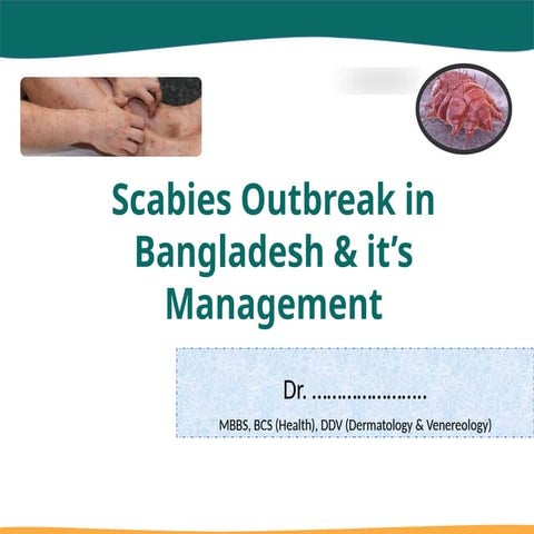 Scabies Outbreak In Bangladesh & It's Management-MSD.pptx