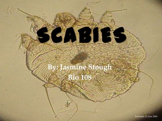 Scabies | PDF