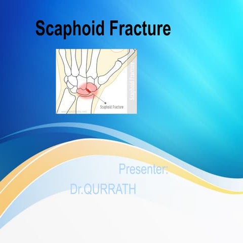 scaphoid FRACTURE(1).pptxccccccccccccccc | PPTX