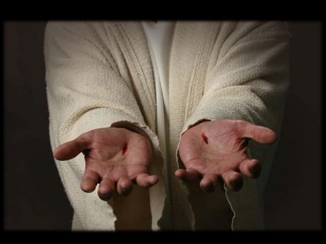 Scars Tell The Story Slides, 4/8/12