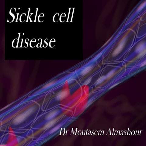 Sickle cell disease