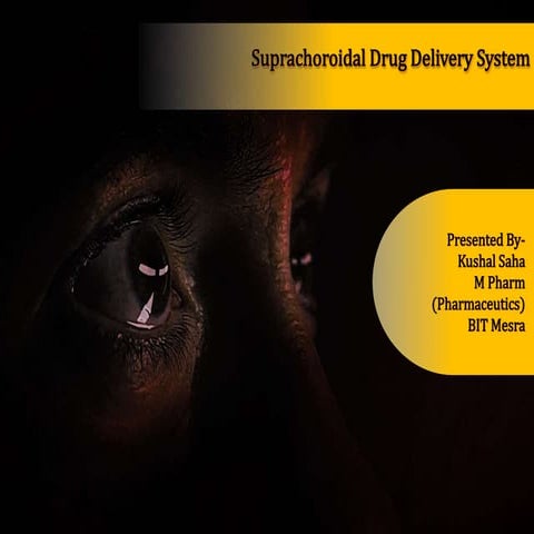 Suprachoroidal drug delivery system | PPTX