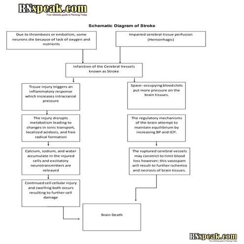Schematic diagram of stroke