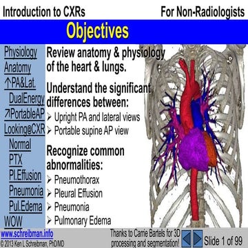 CXR OSCE.pptx in examination point of view | PPTX