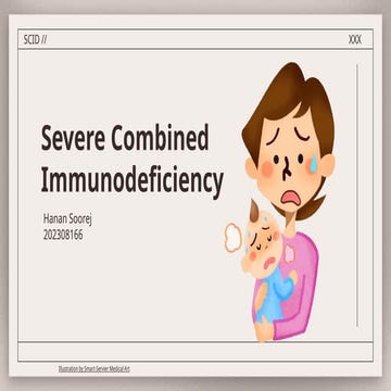 SCID pbl hanan.pptx severe combined immunod | PPTX