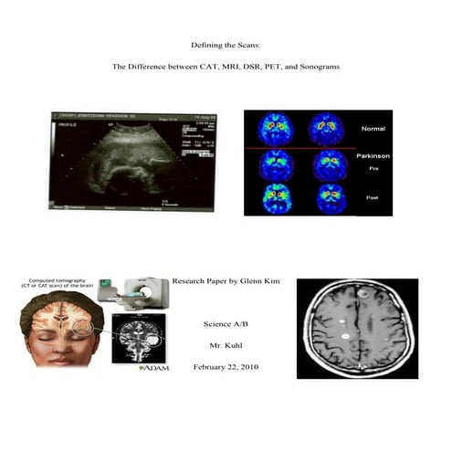 An Explanation Of The Differences Between An MRI And a CT Scan | PDF