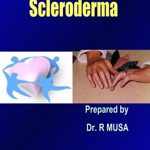 Scleroderma