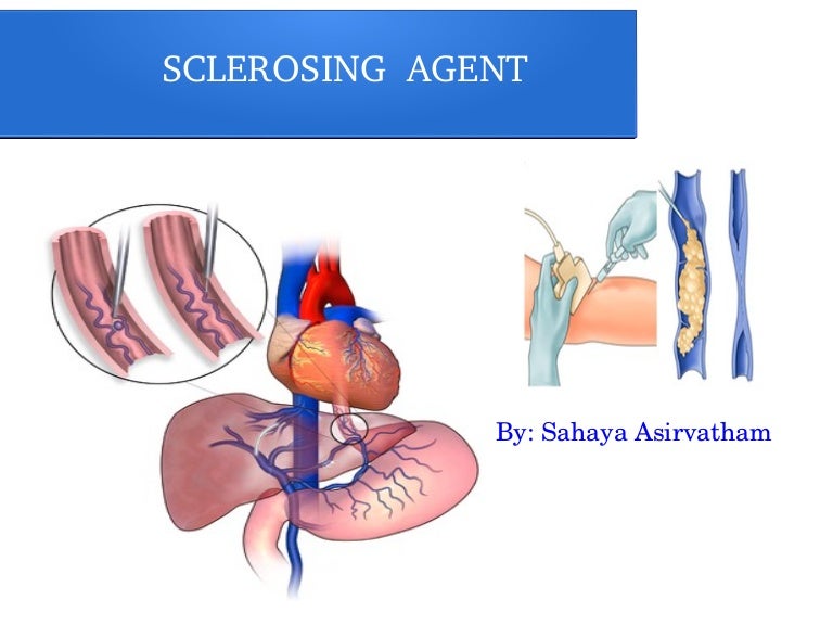 Sclerosing agents