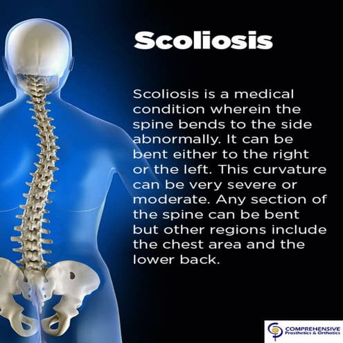 Scoliosis