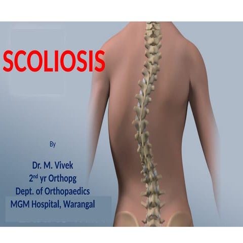 Lenke Classification for Adolescent Idiopathic Scoliosis (AIS) | PPTX