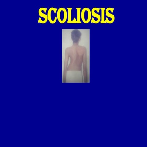 Lenke Classification for Adolescent Idiopathic Scoliosis (AIS) | PPTX