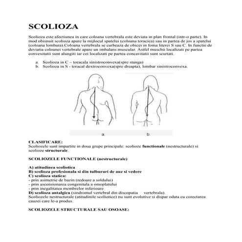 Scolioza