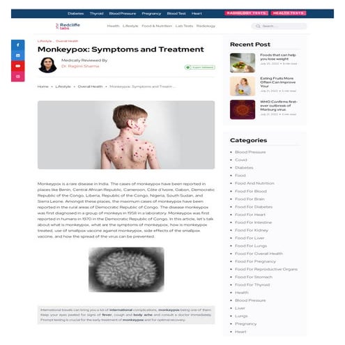 Monkeypox: Symptoms and Treatment