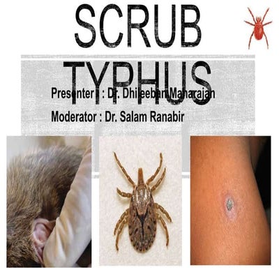 Scrub typhus