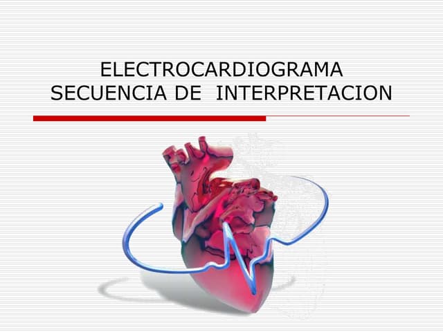 Secuencia de interpretación EKG