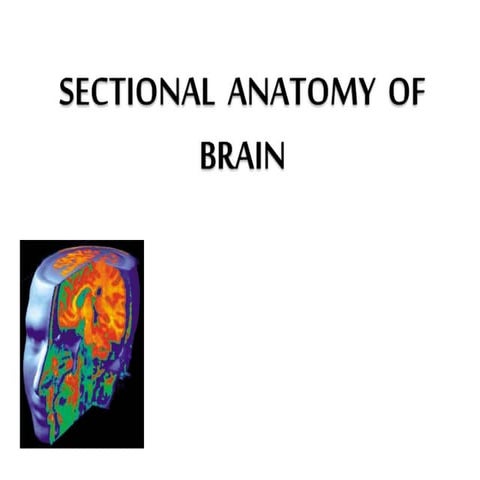 Sectional  anatomy  of  brain  part 1