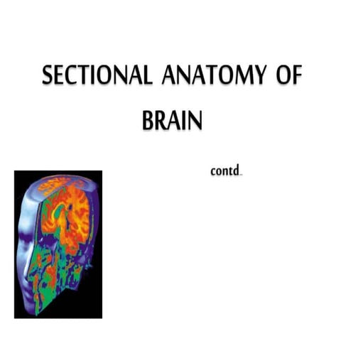 Sectional anatomy of brain   part 2