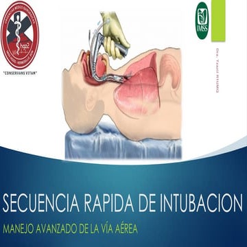 Secuencia_de_intubacion_rapida_SIR copy.pptx