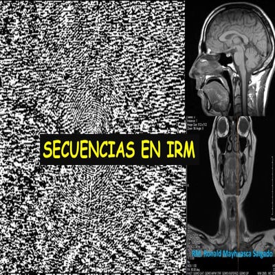 Secuencias y saturacion en irm