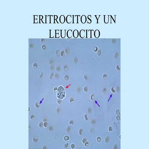 Sedimento urinario 2