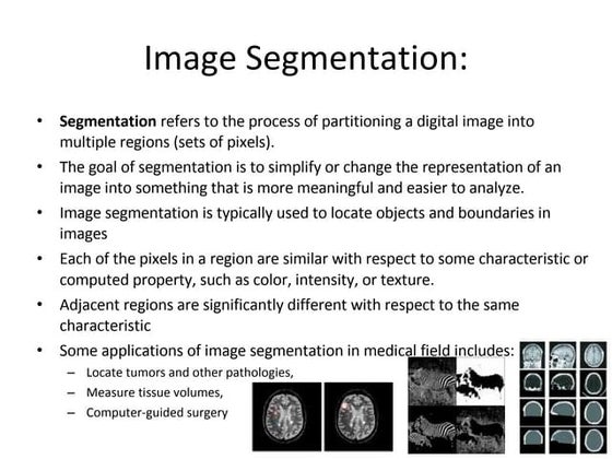Segmentation