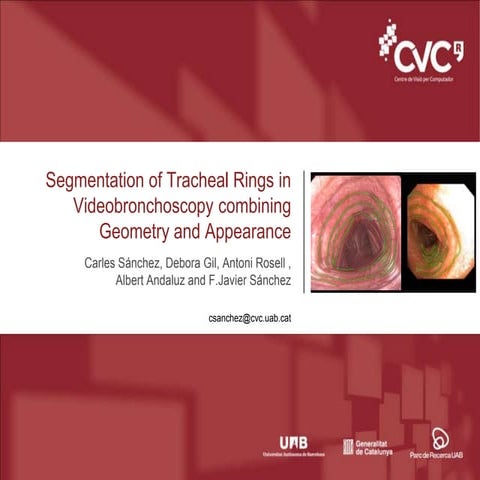 Segmentation of Tracheal Rings in Videobronchoscopy