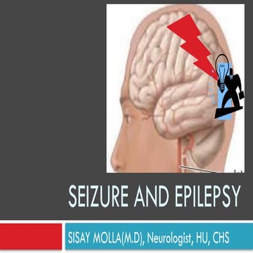 Seizure and eeeeeeeeEpilepsy For C1.pptx