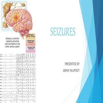Seizures