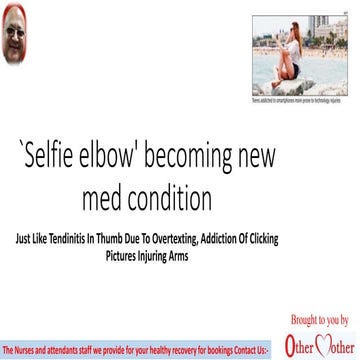 `Selfie elbow' becoming new med condition