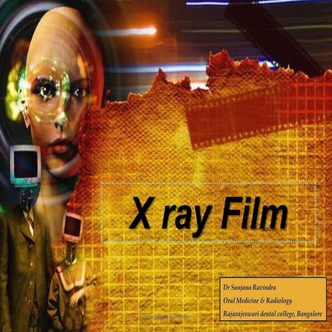  x-ray films by Dr Sanjana Ravindra